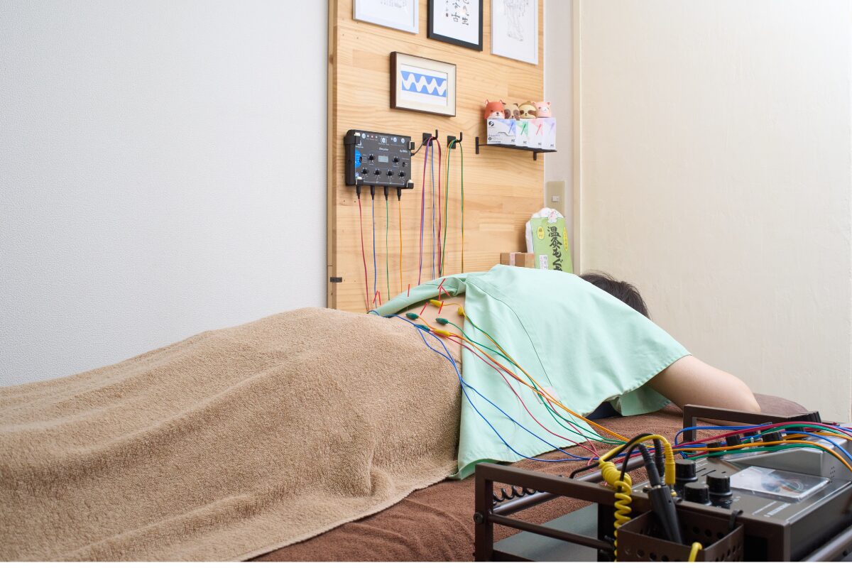 ダブルプラスコースの鍼灸施術