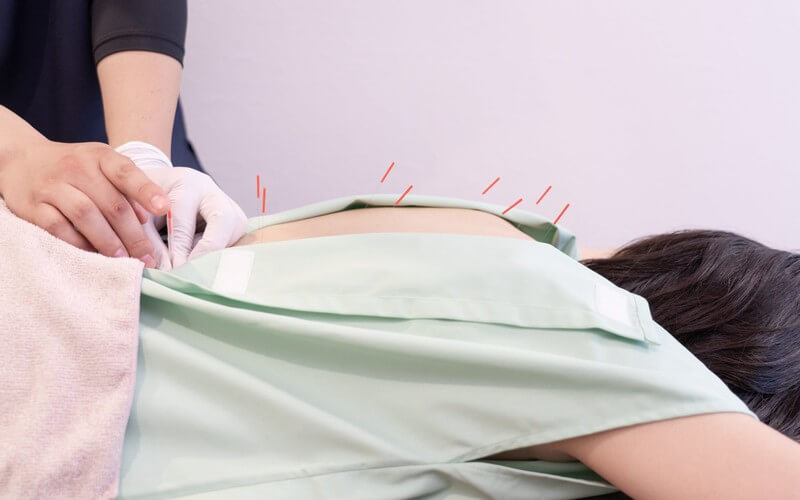 美容鍼＋鍼灸スタンダード