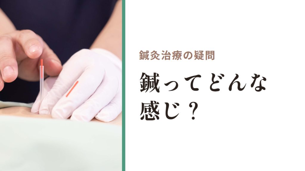 鍼灸治療の疑問｜鍼ってどんな感じ？